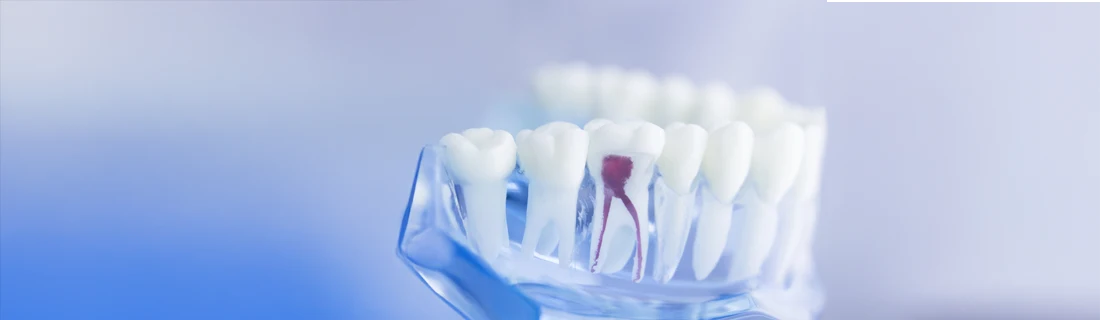Dentist-Wheaton-IL-Dentist-Gum-Disease Dentist-Wheaton-IL-Dentist-Gum-Disease