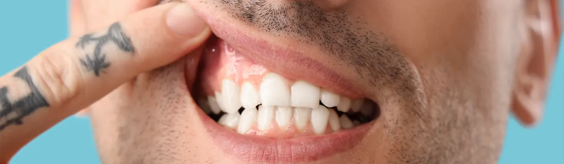 Dentist Wheaton IL Lanap & Lapip Dentist Wheaton IL Lanap & Lapip