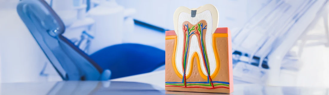Aftercare Essentials: Key Strategies to Avoid Implant Complications in Wheaton IL