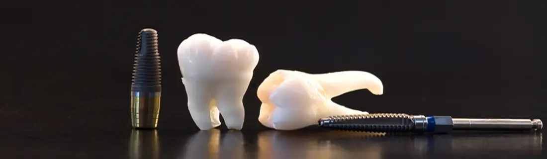 The Crucial Role of Aftercare in Ensuring Long-Lasting Implants in Wheaton IL